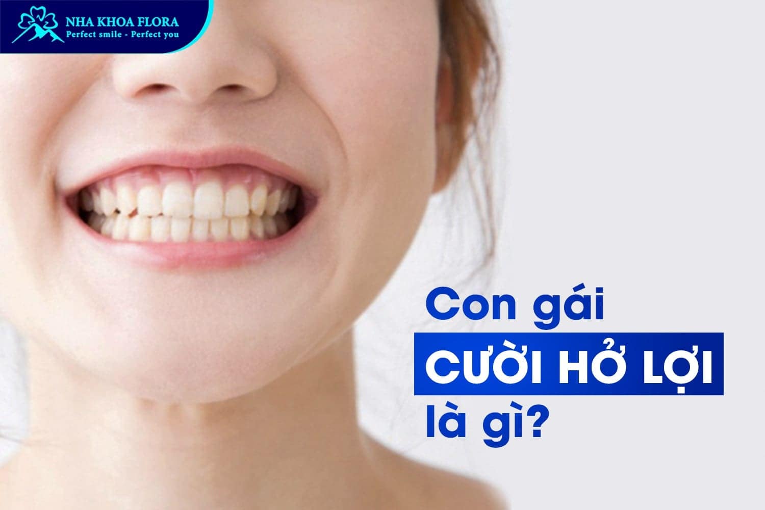 Con Gái Cười Hở Lợi Phải Làm Sao? Tướng Số Thế Nào? - ảnh 1 Con Gái Cười Hở Lợi Phải Làm Sao? Tướng Số Thế Nào? - ảnh 1