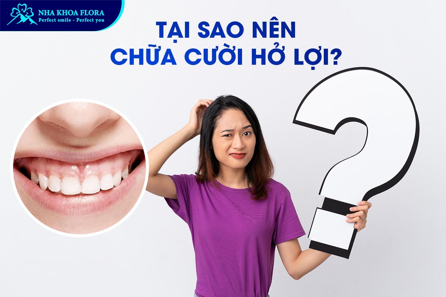 Con Gái Cười Hở Lợi Phải Làm Sao? Tướng Số Thế Nào? - ảnh 3 Con Gái Cười Hở Lợi Phải Làm Sao? Tướng Số Thế Nào? - ảnh 3