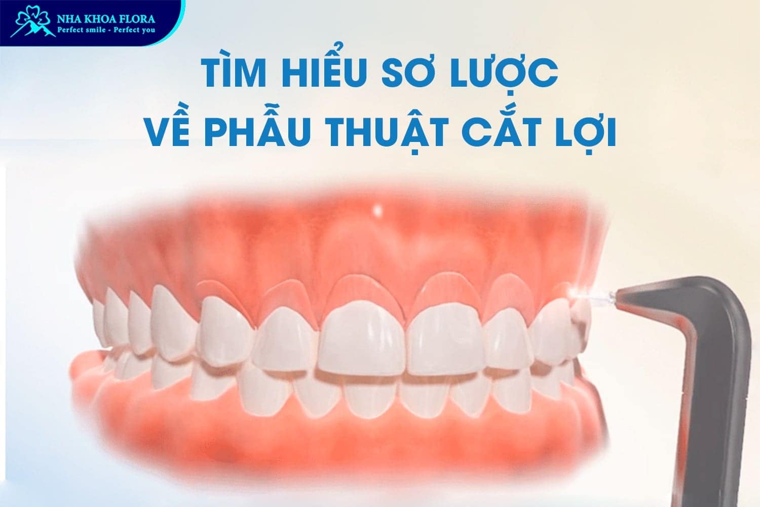 Phẫu Thuật Cười Hở Lợi Có Nguy Hiểm Không? - ảnh 1 Phẫu Thuật Cười Hở Lợi Có Nguy Hiểm Không? - ảnh 1