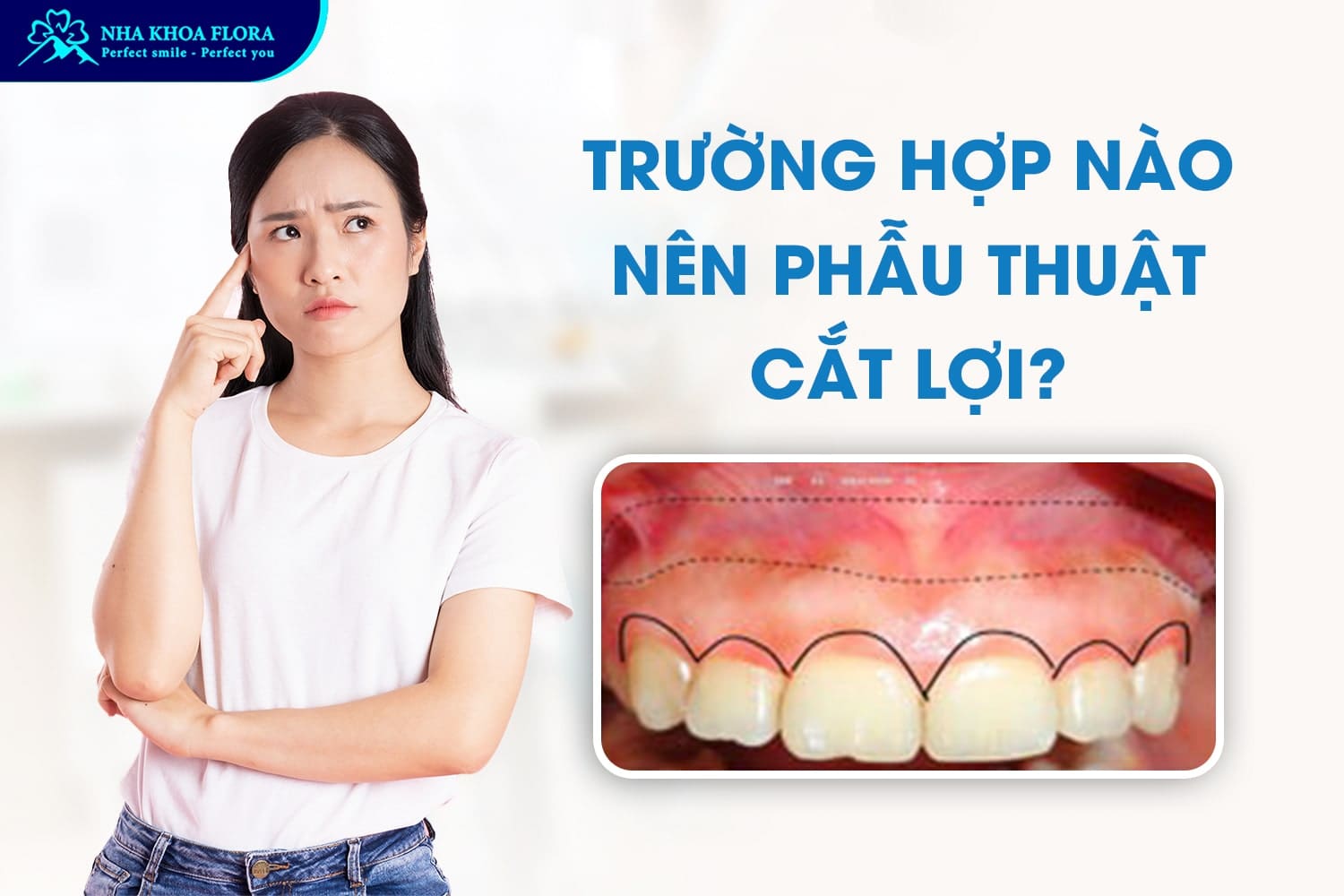 Phẫu Thuật Cười Hở Lợi Có Nguy Hiểm Không? - ảnh 2 Phẫu Thuật Cười Hở Lợi Có Nguy Hiểm Không? - ảnh 2