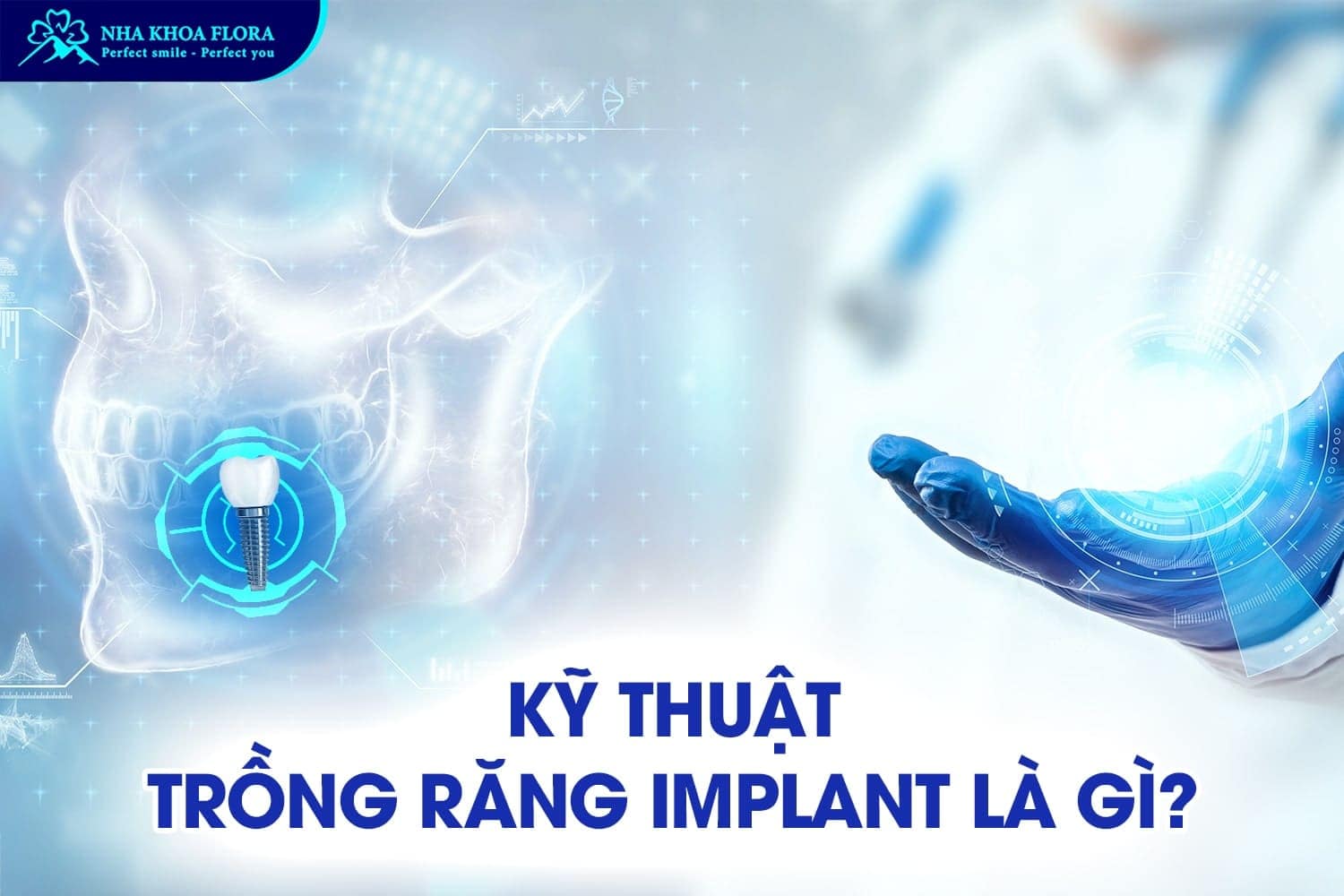 Trồng Răng Implant Giá Bao Nhiêu? - ảnh 1 Trồng Răng Implant Giá Bao Nhiêu? - ảnh 1