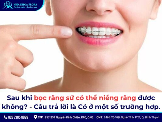 bọc răng sứ có niềng được không - ảnh 1 bọc răng sứ có niềng được không - ảnh 1