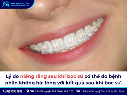bọc răng sứ có niềng được không - ảnh 2 bọc răng sứ có niềng được không - ảnh 2