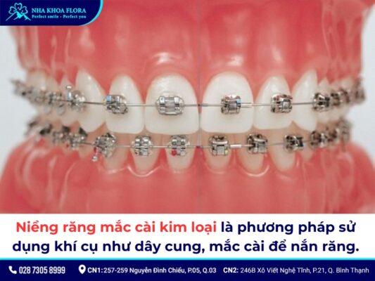 bọc răng sứ có niềng được không - ảnh 4 bọc răng sứ có niềng được không - ảnh 4