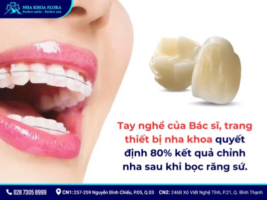 bọc răng sứ có niềng được không - ảnh 7 bọc răng sứ có niềng được không - ảnh 7