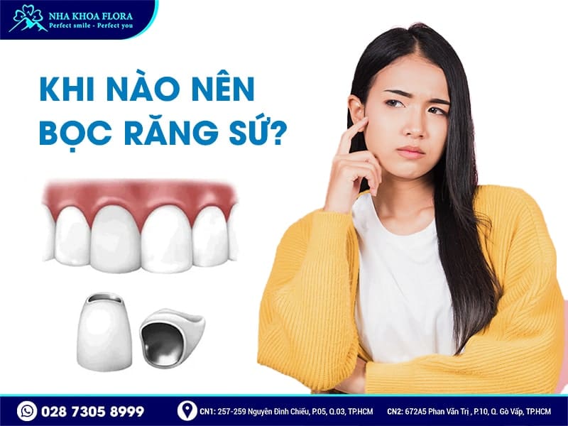 Khi nào nên bọc răng sứ - ảnh 1 Khi nào nên bọc răng sứ - ảnh 1