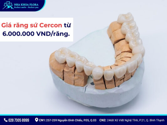 răng sứ Cercon - ảnh 4 răng sứ Cercon - ảnh 4