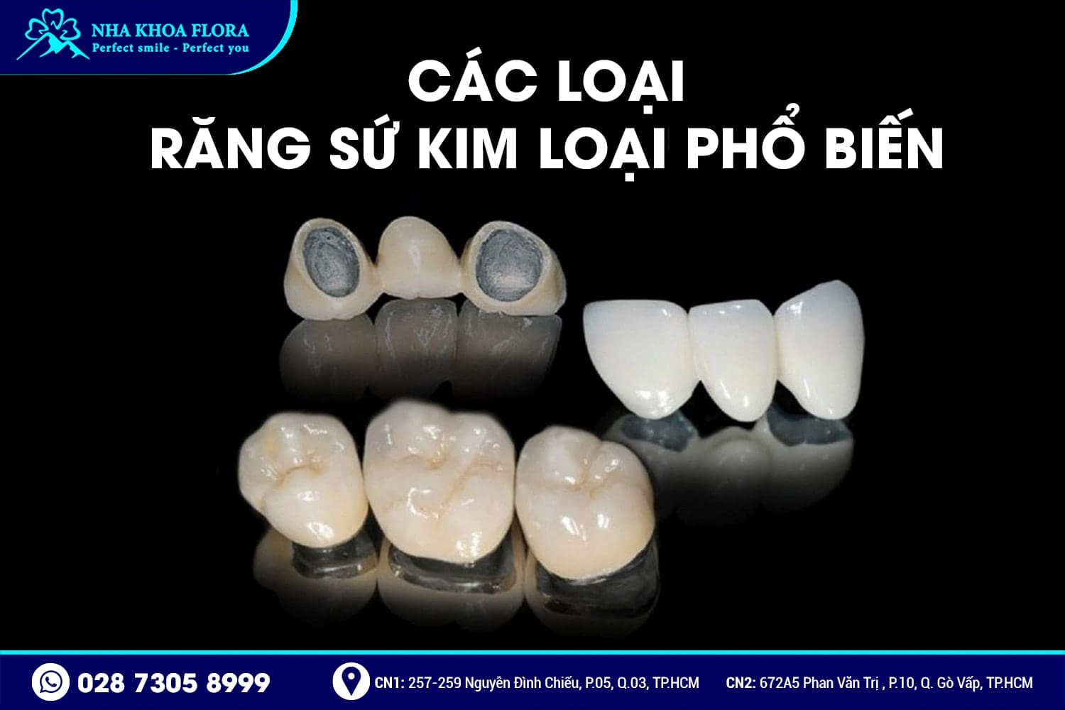 Răng Sứ Kim Loại Là Gì? Có Mấy Loại? Giá Bao Nhiêu? - ảnh 2 Răng Sứ Kim Loại Là Gì? Có Mấy Loại? Giá Bao Nhiêu? - ảnh 2