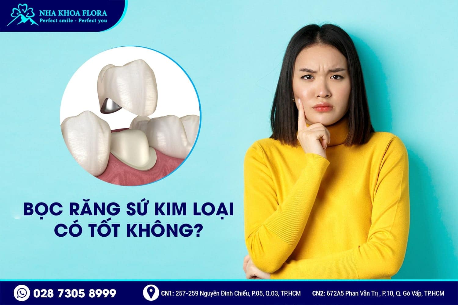 Răng Sứ Kim Loại Là Gì? Có Mấy Loại? Giá Bao Nhiêu? - ảnh 5 Răng Sứ Kim Loại Là Gì? Có Mấy Loại? Giá Bao Nhiêu? - ảnh 5