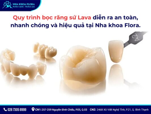 răng sứ lava - ảnh 6 răng sứ lava - ảnh 6