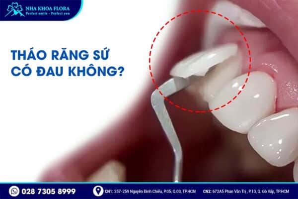 Bọc răng sứ có tháo ra được không? - ảnh 4 Bọc răng sứ có tháo ra được không? - ảnh 4