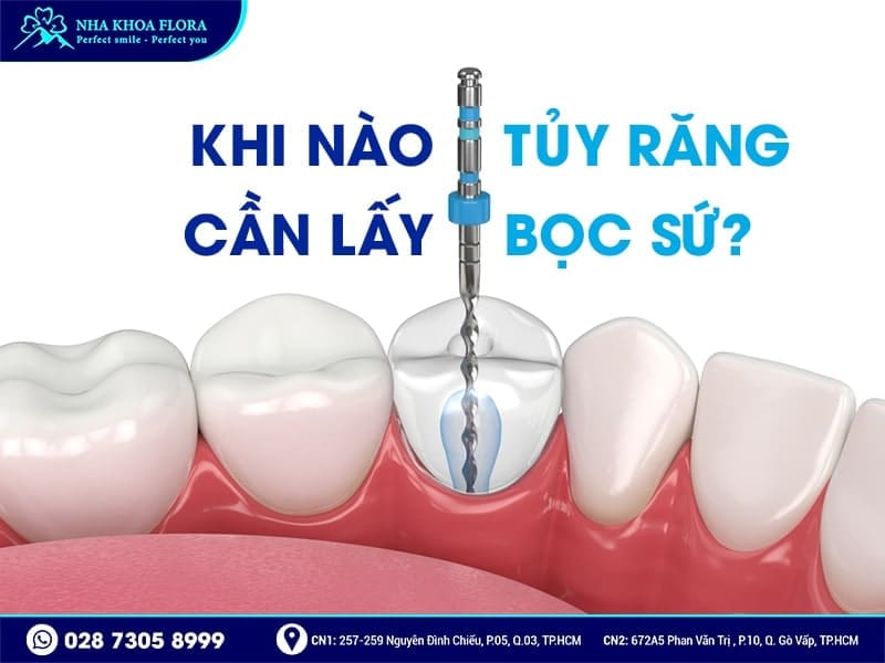 Bọc răng sứ sau khi lấy tủy - ảnh 2 Bọc răng sứ sau khi lấy tủy - ảnh 2