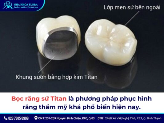 Bọc răng sứ Titan - ảnh 1 Bọc răng sứ Titan - ảnh 1