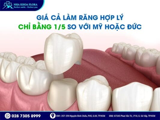 Kiều Bào về nước làm răng sứ - ảnh 3 Kiều Bào về nước làm răng sứ - ảnh 3