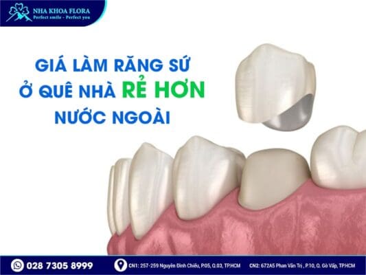 loại răng sứ kiều bào chọn - ảnh 2 loại răng sứ kiều bào chọn - ảnh 2