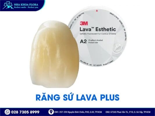 loại răng sứ kiều bào chọn - ảnh 3 loại răng sứ kiều bào chọn - ảnh 3