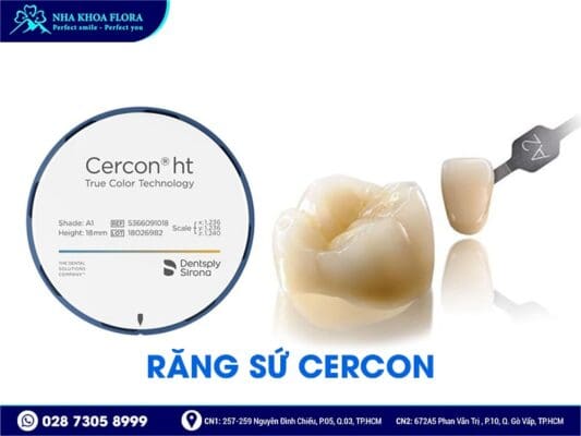 loại răng sứ kiều bào chọn - ảnh 4 loại răng sứ kiều bào chọn - ảnh 4