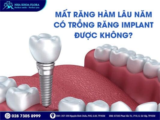 mất răng hàm lâu năm - ảnh 5 mất răng hàm lâu năm - ảnh 5