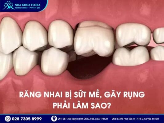 Mất răng nhai nên trồng răng Implant hay bắc cầu răng sứ? - ảnh 2 Mất răng nhai nên trồng răng Implant hay bắc cầu răng sứ? - ảnh 2