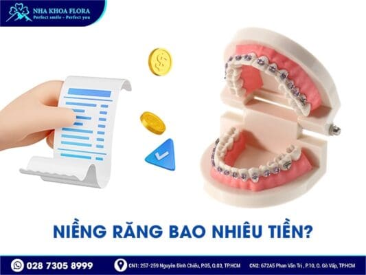 niềng răng bao nhiêu tiền - ảnh 1 niềng răng bao nhiêu tiền - ảnh 1