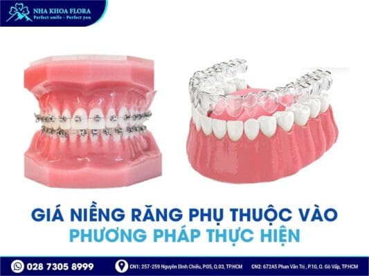 niềng răng bao nhiêu tiền - ảnh 2 niềng răng bao nhiêu tiền - ảnh 2