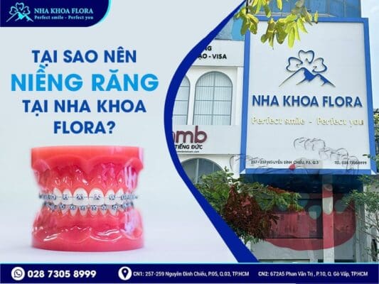 niềng răng bao nhiêu tiền - ảnh 5 niềng răng bao nhiêu tiền - ảnh 5