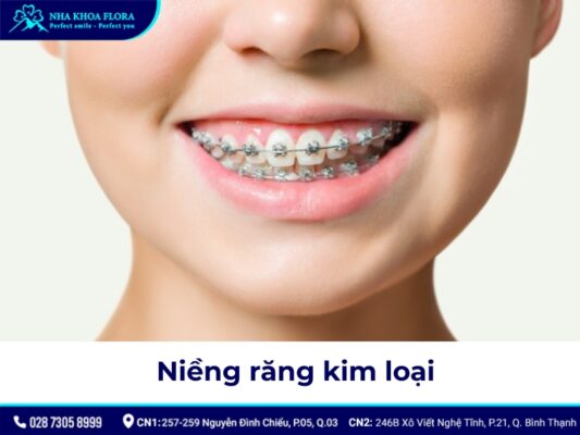 niềng răng có đau không - ảnh 2 niềng răng có đau không - ảnh 2