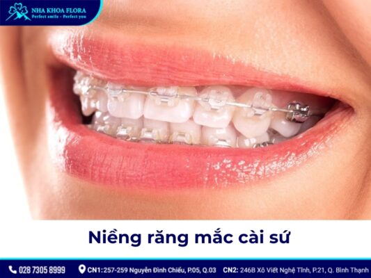 niềng răng có đau không - ảnh 3 niềng răng có đau không - ảnh 3