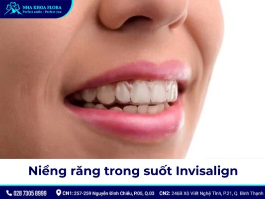 niềng răng có đau không - ảnh 6 niềng răng có đau không - ảnh 6
