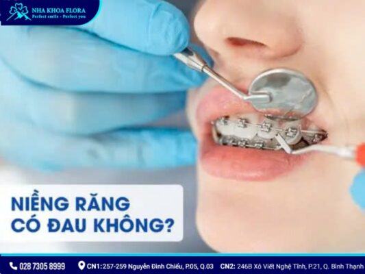 niềng răng có đau không - ảnh 7 niềng răng có đau không - ảnh 7