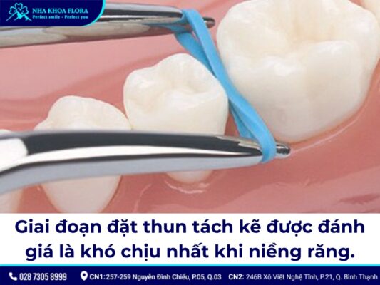 niềng răng có đau không - ảnh 8 niềng răng có đau không - ảnh 8