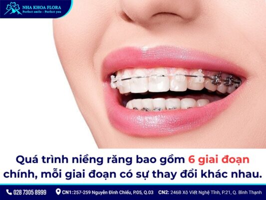 niềng răng mất bao lâu - ảnh 3 niềng răng mất bao lâu - ảnh 3