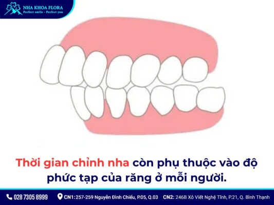 niềng răng mất bao lâu - ảnh 4 niềng răng mất bao lâu - ảnh 4
