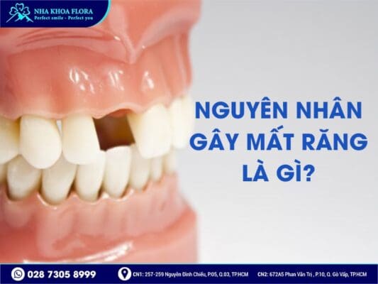 Phương pháp trồng răng giả nào tốt nhất hiện nay? - ảnh 1 Phương pháp trồng răng giả nào tốt nhất hiện nay? - ảnh 1