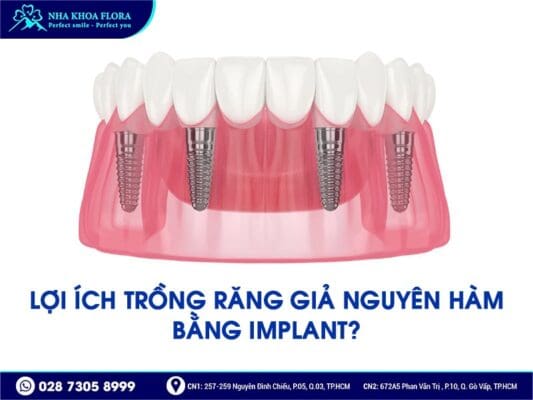 trồng răng nguyên hàm - ảnh 1 trồng răng nguyên hàm - ảnh 1