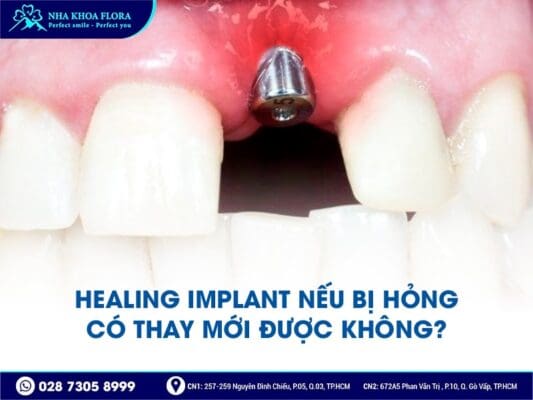 Healing Implant - ảnh 5 Healing Implant - ảnh 5