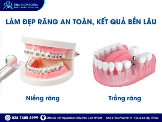 Ưu đãi làm đẹp răng cuối năm - ảnh 2 Ưu đãi làm đẹp răng cuối năm - ảnh 2