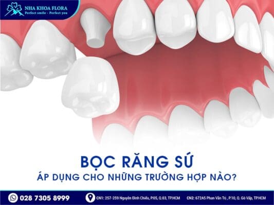 lưu ý làm răng sứ đón Tết - ảnh 1 lưu ý làm răng sứ đón Tết - ảnh 1