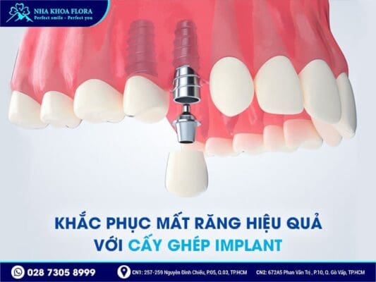 tặng ba mẹ hàm răng khỏe - ảnh 5 tặng ba mẹ hàm răng khỏe - ảnh 5