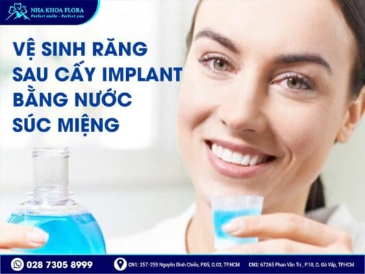 Cách vệ sinh răng Implant - ảnh 4 Cách vệ sinh răng Implant - ảnh 4