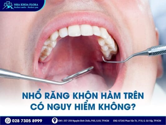 nhổ răng khôn có nguy hiểm không - ảnh 2 nhổ răng khôn có nguy hiểm không - ảnh 2