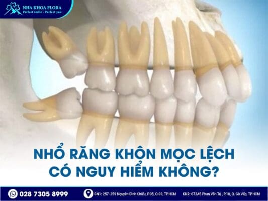 nhổ răng khôn có nguy hiểm không - ảnh 4 nhổ răng khôn có nguy hiểm không - ảnh 4