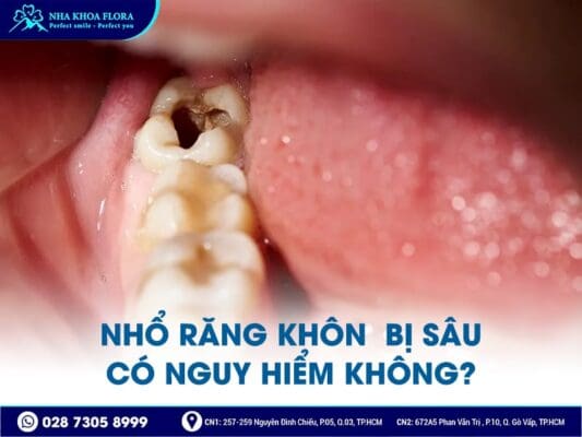 nhổ răng khôn có nguy hiểm không - ảnh 5 nhổ răng khôn có nguy hiểm không - ảnh 5