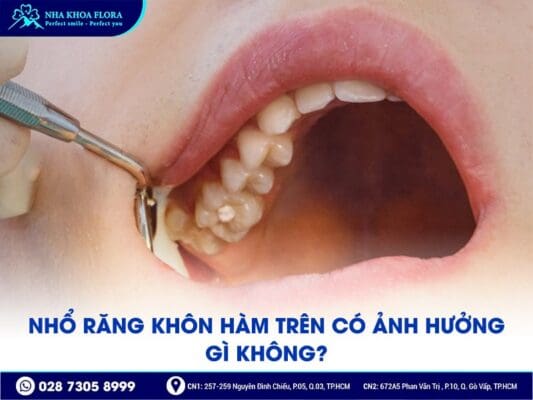 nhổ răng khôn hàm trên - ảnh 1 nhổ răng khôn hàm trên - ảnh 1