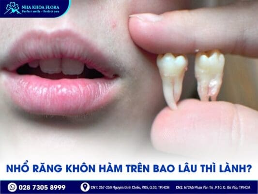 nhổ răng khôn hàm trên - ảnh 4 nhổ răng khôn hàm trên - ảnh 4