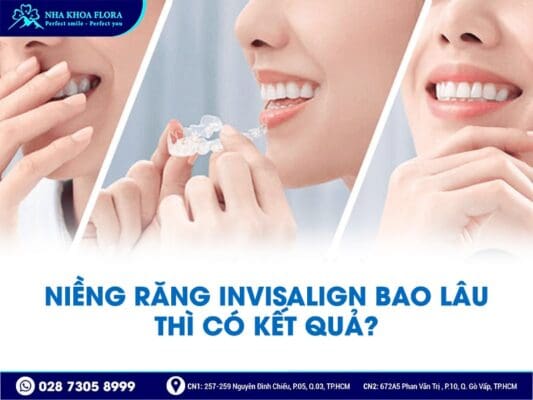 Niềng răng Invisalign có hiệu quả không? - ảnh 2 Niềng răng Invisalign có hiệu quả không? - ảnh 2
