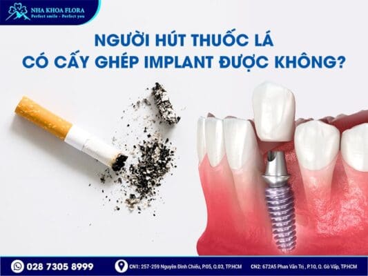 trồng răng Implant có hút thuốc được không - ảnh 2 trồng răng Implant có hút thuốc được không - ảnh 2
