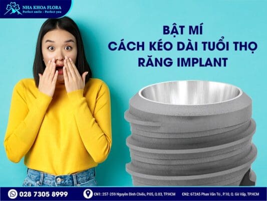 trồng răng Implant có hút thuốc được không - ảnh 4 trồng răng Implant có hút thuốc được không - ảnh 4