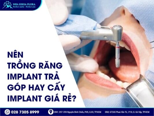 Trồng răng Implant trả góp - ảnh 4 Trồng răng Implant trả góp - ảnh 4