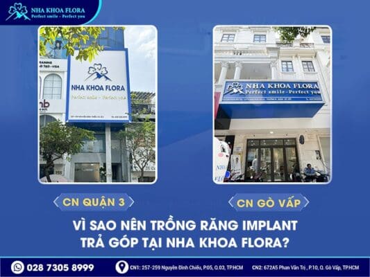 Trồng răng Implant trả góp - ảnh 2 Trồng răng Implant trả góp - ảnh 2